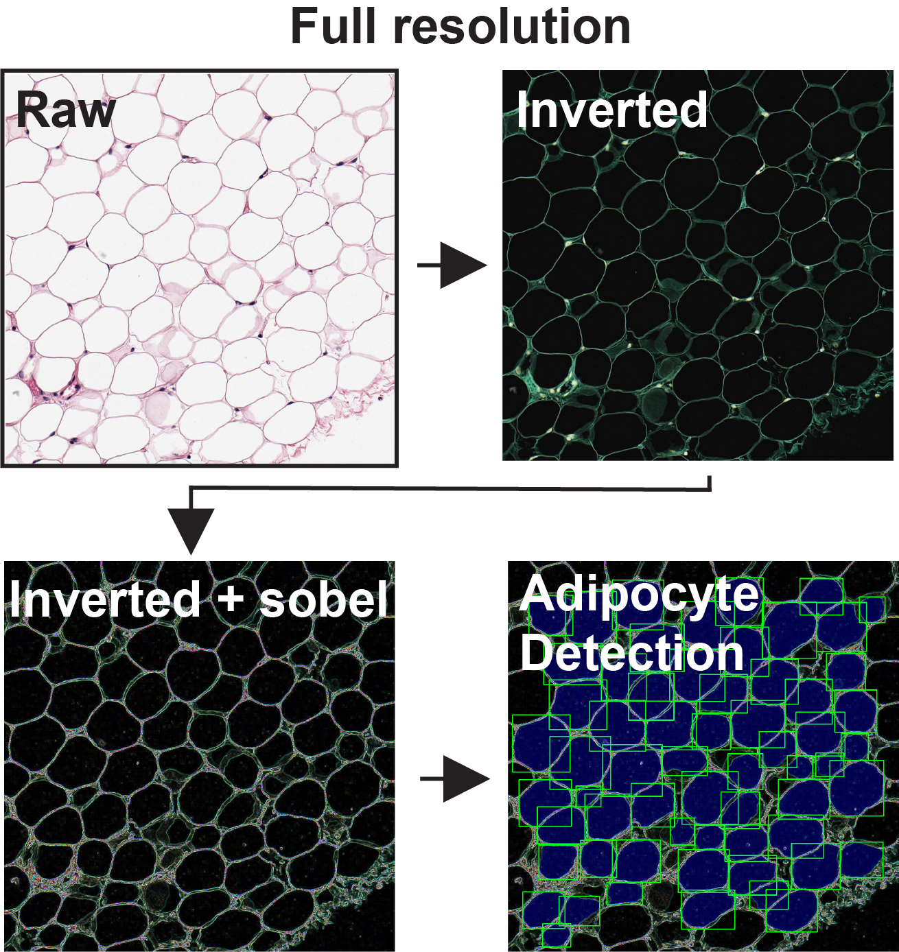 Full-resolution preprocessing showing raw, inverted, Sobel-enhanced, and adipocyte-detection stages.